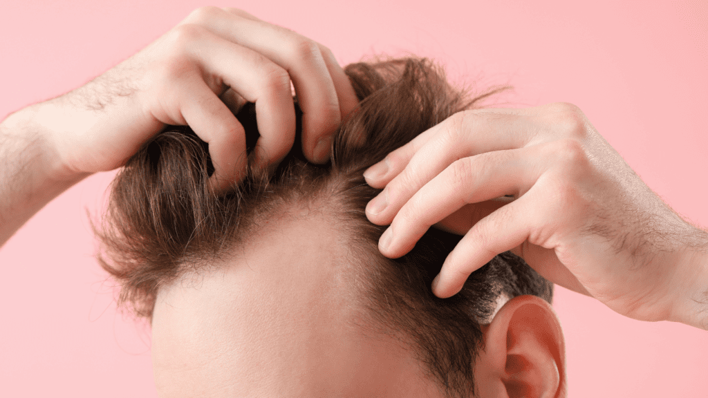 Whey Protein and Hair Health: The Truth Behind Hair Growth 2 Whey Protein and Hair Health