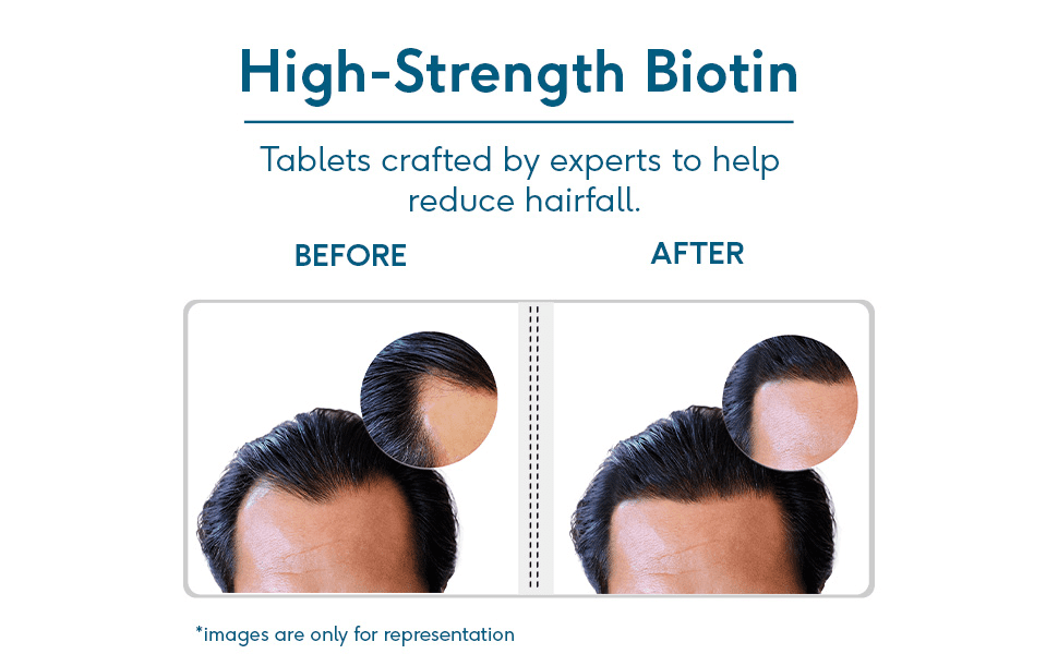 Results Of HK Vitals Biotin